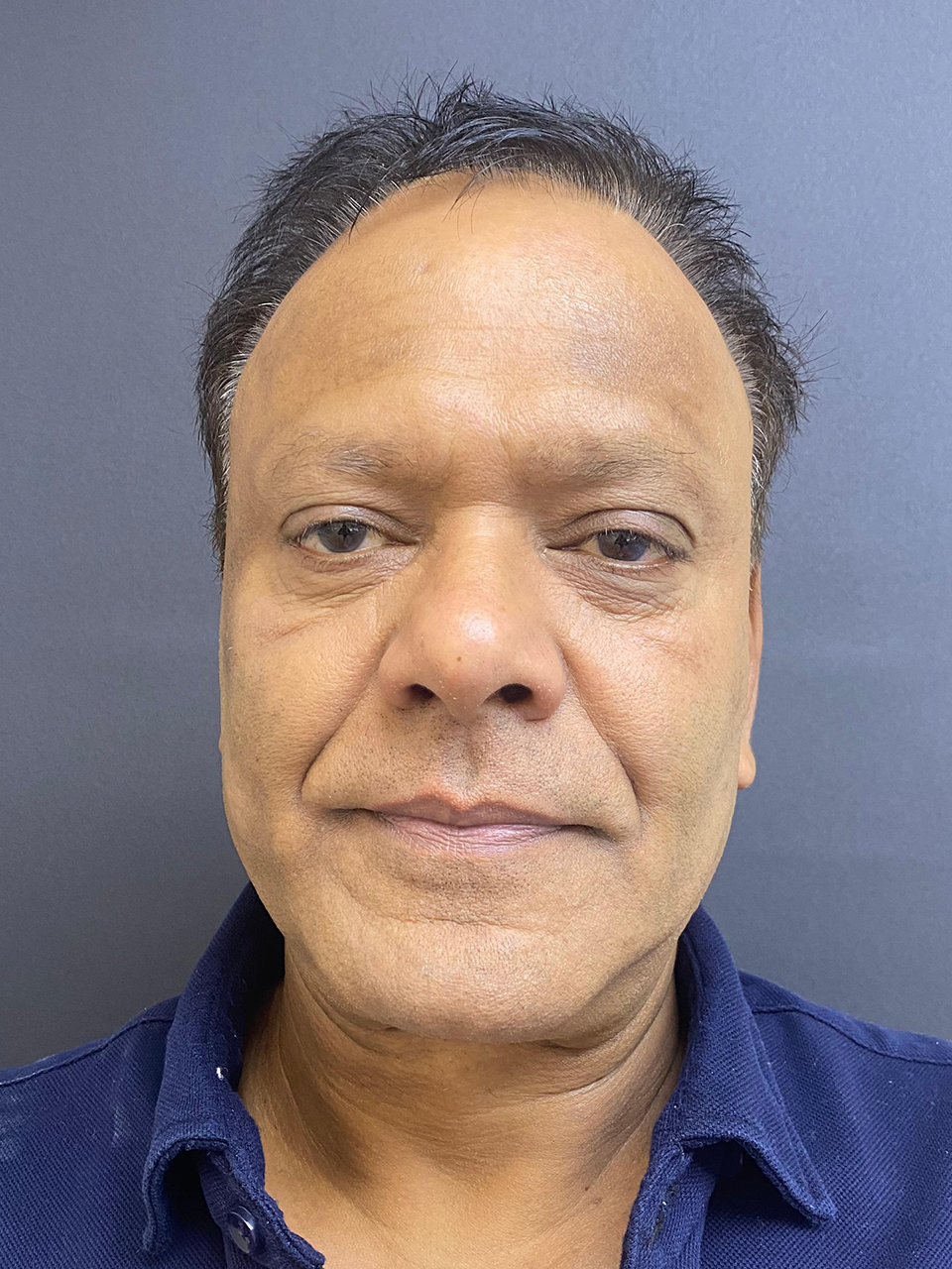 Before treatment
